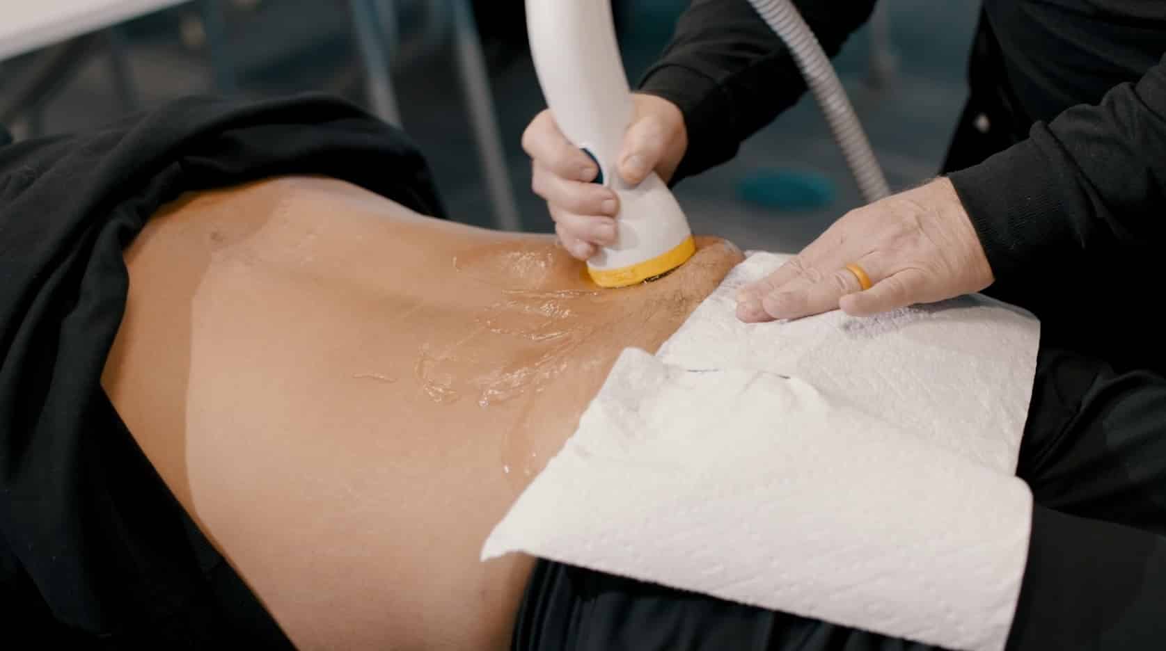 SoftWave Therapy on lower back.